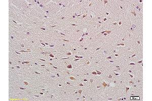 Formalin-fixed and paraffin embedded rat brain labeled with Anti- Bax Polyclonal Antibody, Unconjugated (ABIN725375) at 1:200, followed by conjugation to the secondary antibody and DAB staining. (BAX 抗体  (AA 84-175))