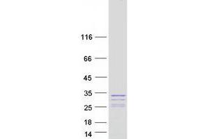 Western Blotting (WB) image for Secretogranin V (7B2 Protein) (SCG5) (Transcript Variant 2) protein (Myc-DYKDDDDK Tag) (ABIN2731596)