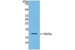 Western blot analysis of recombinant Rat IFNg. (Interferon gamma 抗体  (AA 23-156))