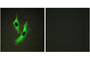 Immunofluorescence analysis of HeLa cells, using STEAP4 Antibody. (STEAP4 抗体  (AA 201-250))