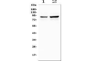 Western blot analysis of SEMA3E using anti-SEMA3E antibody (ABIN6719619).