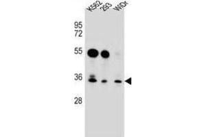 Western Blotting (WB) image for anti-GLI Pathogenesis-Related 1 Like 2 (GLIPR1L2) antibody (ABIN2996840) (GLIPR1L2 抗体)