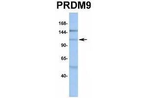 Host:  Rabbit  Target Name:  PRDM9  Sample Type:  MCF7  Antibody Dilution:  1. (PRDM9 抗体  (Middle Region))