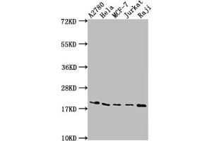 Western Blot Positive WB detected in: A2780 whole cell lysate, Hela whole cell lysate, MCF-7 whole cell lysate, Jurkat whole cell lysate, Raji whole cell lysate All lanes: EIF5A antibody at 1:2000 Secondary Goat polyclonal to rabbit IgG at 1/50000 dilution Predicted band size: 17, 21 kDa Observed band size: 18 kDa (Recombinant EIF5A 抗体)