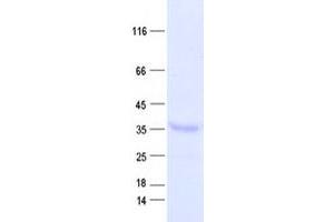 Western Blotting (WB) image for Dihydrouridine Synthase 4-Like (DUS4L) protein (His tag) (ABIN2719821)