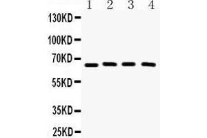 Western Blotting (WB) image for anti-Cryptochrome 2 (Photolyase-Like) (CRY2) (AA 171-200), (N-Term) antibody (ABIN3042760)