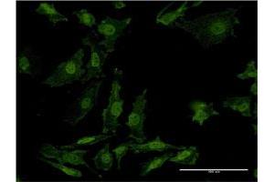 Immunofluorescence of monoclonal antibody to AKT2 on HeLa cell. (AKT2 抗体  (AA 100-189))