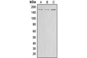 Western blot analysis of ABCA8 expression in HEK293T (A), Raw264. (ABCA8 抗体  (Center))