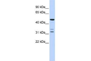 WB Suggested Anti-HTRA4 Antibody Titration: 0.