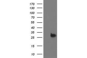 Western Blotting (WB) image for anti-Deoxythymidylate Kinase (Thymidylate Kinase) (DTYMK) antibody (ABIN1497921) (DTYMK 抗体)