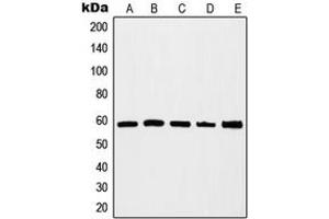Western blot analysis of c-Myc expression in HEK293A (A), Jurkat (B), K562 (C), HeLa (D), NIH3T3 (E) whole cell lysates. (c-MYC 抗体  (C-Term))