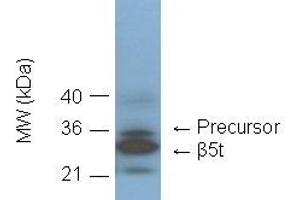 Western blot showing detection of 20S proteasome subunit beta5t in C57/BL6 mouse thymus lysate by  at 1:1000 dilution. (Proteasome 20S Beta5t Subunit 抗体)
