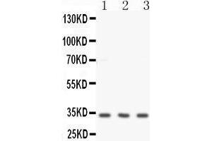 Anti-Calponin antibody,Western blotting All lanes: Anti -Calponin  at 0. (CNN1 抗体  (C-Term))