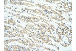 Rabbit Anti-PHF11 antibody         Paraffin Embedded Tissue:  Human Heart    cell Cellular Data:  cardiac cell    Antibody Concentration:  4. (PHF11 抗体  (Middle Region))