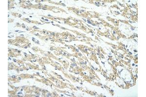 Rabbit Anti-PHF11 antibody         Paraffin Embedded Tissue:  Human Heart    cell Cellular Data:  cardiac cell    Antibody Concentration:  4.