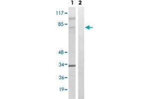 Western blot analysis of Lane 1: Untreated HeLa cell lysates, Lane 2: Synthesized peptide treated HeLa cell lysates reacted with MDM4 (phospho S367) polyclonal antibody  at 1:500-1:3000 dilution. (MDM4-binding Protein 抗体  (pSer367))