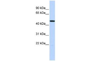WB Suggested Anti-HTR3C Antibody Titration: 0. (HTR3C 抗体  (Middle Region))