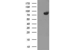 Western Blotting (WB) image for anti-Acyl-CoA Synthetase Short-Chain Family Member 2 (ACSS2) antibody (ABIN1496428) (ACSS2 抗体)