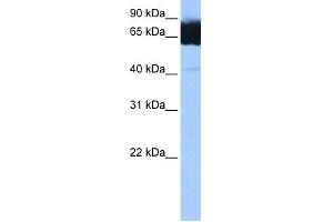 WB Suggested Anti-TTC12 Antibody Titration: 0. (TTC12 抗体  (C-Term))