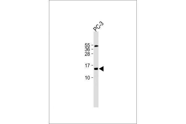 FUNDC2 抗体  (C-Term)