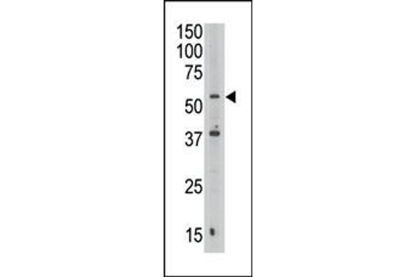 Septin 9 抗体  (C-Term)
