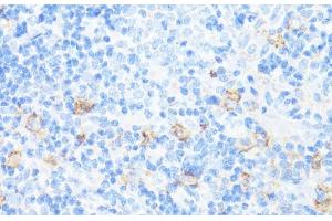 Immunohistochemistry of paraffin-embedded Rat spleen using CD11A Polyclonal Antibody at dilution of 1:100 (40x lens). (ITGAL 抗体)