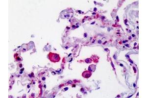 Human Lung: Formalin-Fixed, Paraffin-Embedded (FFPE) (SMO 抗体  (N-Term))