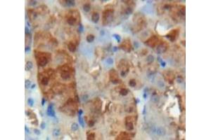 IHC-P analysis of Kidney tissue, with DAB staining. (Adrenomedullin 抗体  (AA 24-171))