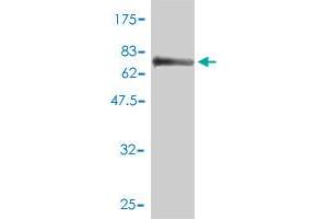 Western Blot detection against Immunogen (77. (MPP1 抗体  (AA 1-466))