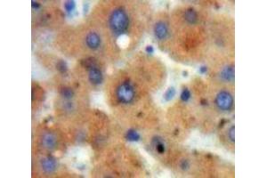 Used in DAB staining on fromalin fixed paraffin-embedded Liver tissue (HDAC6 抗体  (AA 1038-1204))