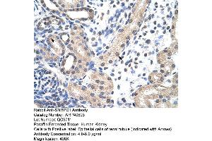 Rabbit Anti-SNRPD1 Antibody  Paraffin Embedded Tissue: Human Kidney Cellular Data: Epithelial cells of renal tubule Antibody Concentration: 4. (SNRPD1 抗体  (N-Term))