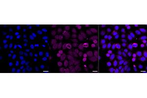 Immunocytochemical staining of HepG2 cells with Cyclin dependent kinase 1 antibody (ABIN7798205), 1:1,000). (Recombinant CDK1 抗体)