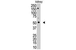 The RNF216 polyclonal antibody  is used in Western blot to detect RNF216 in mouse kidney tissue lysate. (RNF216 抗体  (C-Term))