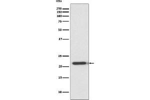 Western blot analysis of TIMP2 expression in HeLa cell lysate.