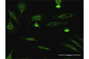 Immunofluorescence (IF) image for anti-Enoyl CoA Hydratase, Short Chain, 1, Mitochondrial (ECHS1) (AA 1-290) antibody (ABIN515147)