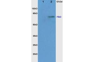 Western Blotting (WB) image for anti-V-Raf-1 Murine Leukemia Viral Oncogene Homolog 1 (RAF1) (pSer338), (pTyr340) antibody (ABIN733628)