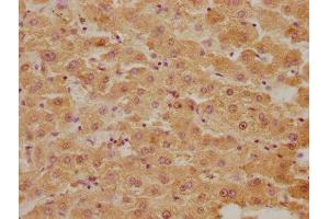 IHC image of ABIN7152961 diluted at 1:300 and staining in paraffin-embedded human liver tissue performed on a Leica BondTM system. (BLVRB 抗体  (AA 2-206))