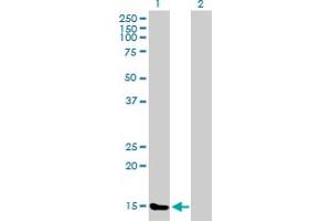 Western Blot analysis of TXNL4B expression in transfected 293T cell line by TXNL4B MaxPab polyclonal antibody.