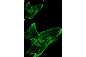 Unlabeled ATX-II successfully blocks Na+ channels access. (ATX-II peptide (Atto 647N))