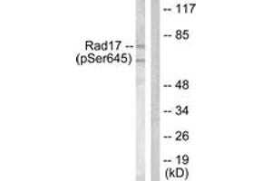 Western blot analysis of extracts from HeLa cells treated with UV 15', using RAD17 (Phospho-Ser645) Antibody. (RAD17 抗体  (pSer645))