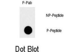Dot blot analysis of MYC (phospho T58) polyclonal antibody  on nitrocellulose membrane. (c-MYC 抗体  (pThr58))