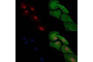 ABIN7094707 and ABIN7098758 staining  cells by IF/ICC. (HAND2 抗体  (Internal Region))