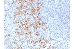 Formalin-fixed, paraffin-embedded human Spleen stained with CD162 Monoclonal Antibody (PSGL1/1601).