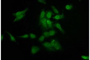 Immunofluorescence staining of Hela cells with ABIN7154937 at 1:200, counter-stained with DAPI. (ARIP4 抗体  (AA 1122-1296))