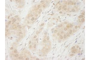 Immunohistochemistry (IHC) image for anti-Spleen tyrosine Kinase (SYK) (AA 250-300) antibody (ABIN7448821) (SYK 抗体  (AA 250-300))