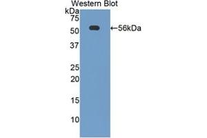 Western blot analysis of the recombinant protein. (CD46 抗体  (AA 157-365))