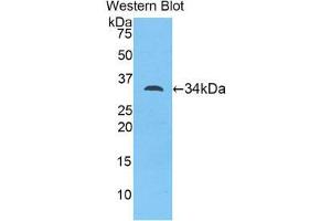Western Blotting (WB) image for anti-Myosin ID (MYO1D) (AA 581-847) antibody (ABIN1078392) (Myosin ID 抗体  (AA 581-847))