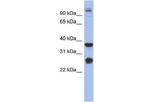 WB Suggested Anti-BGN Antibody Titration: 0. (Biglycan 抗体  (Middle Region))