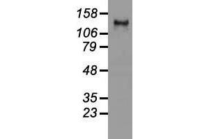 Western blot analysis of 35 µg of cell extracts from human (HeLa) cells using anti-L1CAM antibody. (L1CAM 抗体)