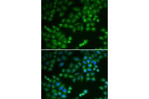 Immunofluorescence (IF) image for anti-Ribosomal Protein L5 (RPL5) (AA 1-95) antibody (ABIN3015786)